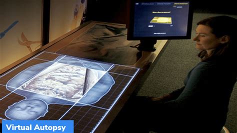 Virtual autopsy – GKToday