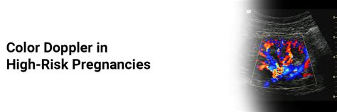 Color Doppler in high-risk pregnancies