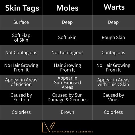 Differences Between Warts, Skin Tags and Moles — LIV Dermatology ...