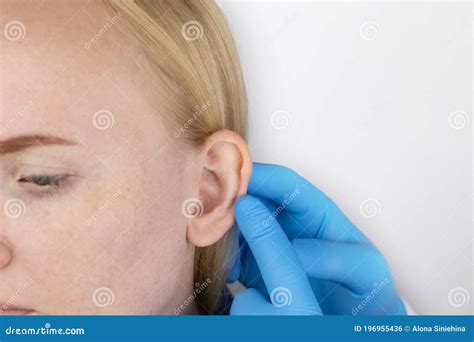 Darwin`s Tubercle on the Ear. the Girl at the Reception at the Plastic ...