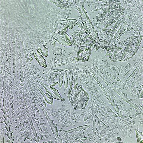 Fern Test Overview: Appearance and Clinical Significance