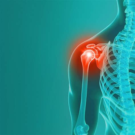 Shoulder conditions and Upper Limb Orthopaedics’., February 7 2024 ...