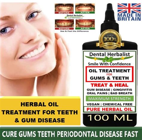 PURE BOTANICAL OIL REMEDIES GINGIVITIS GUM DISEASE, ORAL PAINS BAD BREATH 100 ML | eBay