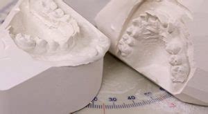 Image result for How to Take Study Models with Plaster Lab