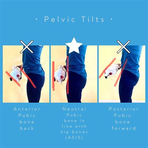 Understanding the Impact of Pelvic Tilt on Your Pelvic Health