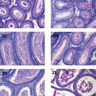 Image result for Transillumination Test Testis