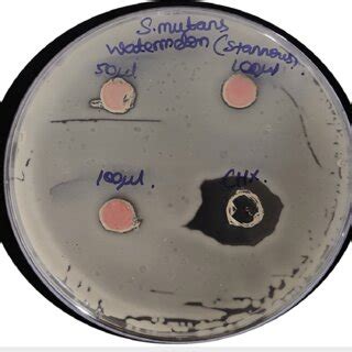 Image result for Agar Plug Diffusion Method