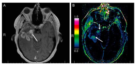 Current Concepts in Multi-Modality Imaging of Solid Tumor Angiogenesis