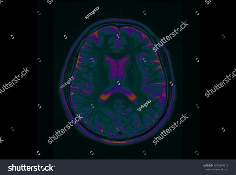 High Res Brain Scan Image 的图像结果