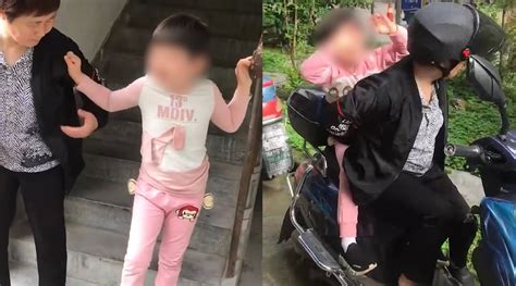 9岁女孩患天使综合征 奶奶将患病孙女绑在身上看病_凤凰网