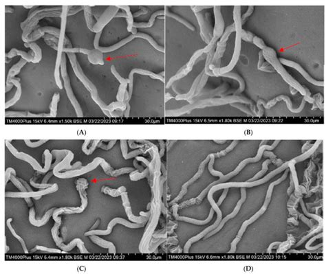 Evaluation of Bacillus subtilis Czk1 Metabolites by LC–MS/MS and Their ...