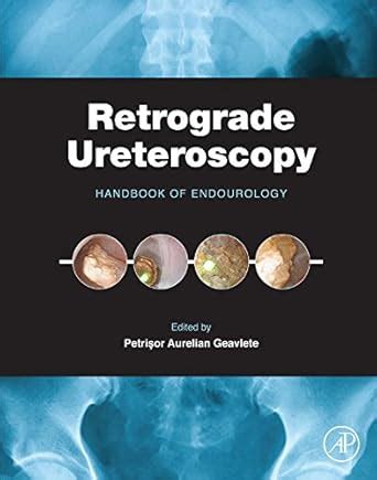 Retrograde Ureteroscopy: Handbook of Endourology eBook : Geavlete ...