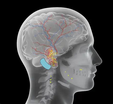 Image result for Transillumination Normal Head