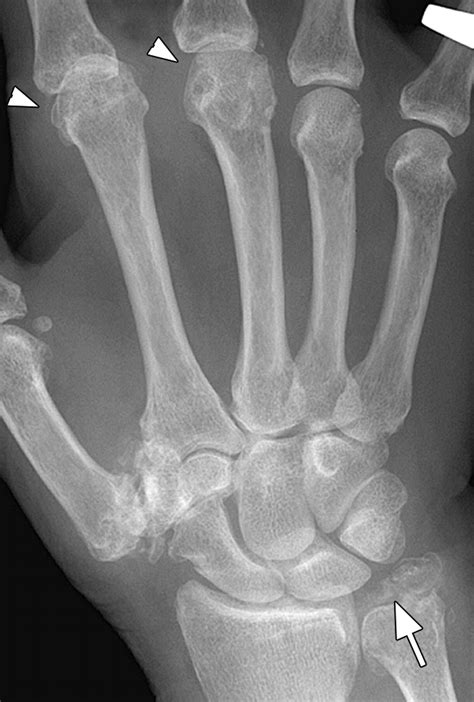 Pin on My passion calls radiology