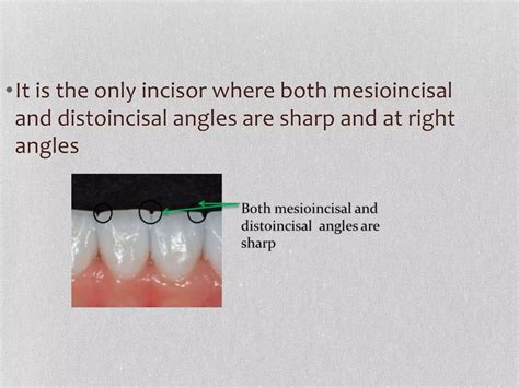 lower/mandibular central incisor | PPTX