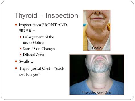 Image result for Thyroid Function Algorithm