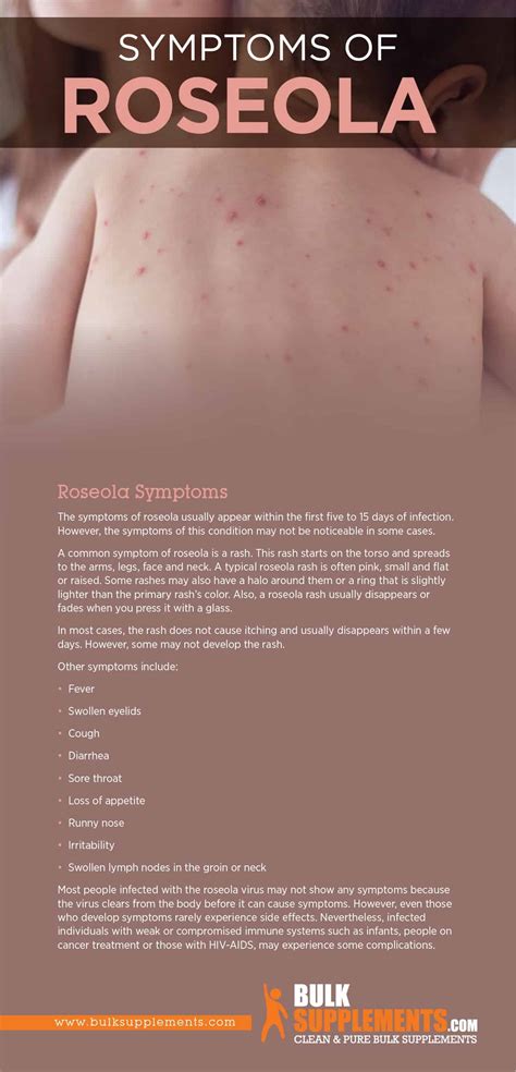 Roseola: Symptoms, Causes & Treatment