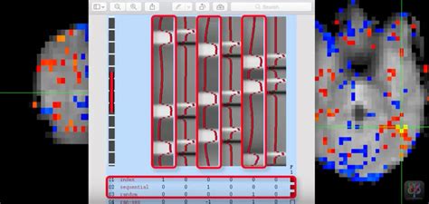 Image result for How to Digitize FSL