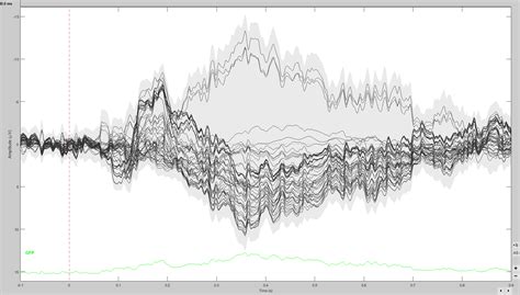 Image result for EEG Source Localization