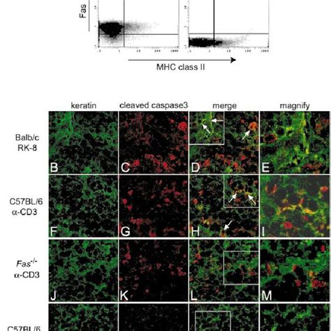 Image result for What Is Thymic Involution