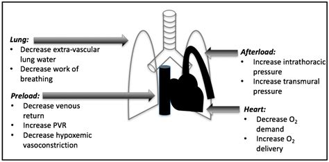 Management of Mechanical Ventilation in Decompensated Heart Failure