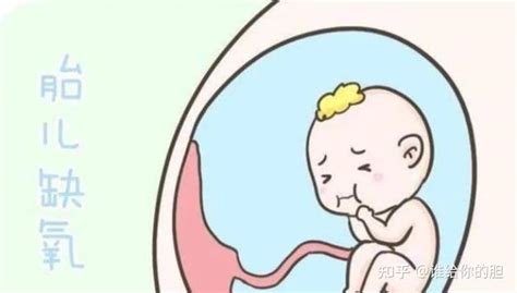 胎儿缺氧会有哪些症状？ - 知乎