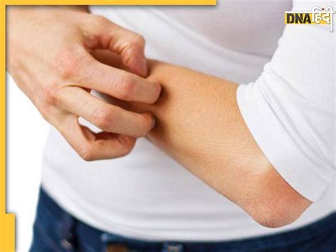 Heat Waves के कारण गर्मी और पसीने से बुरा हाल, स्किन पर पड़ गए हैं ...