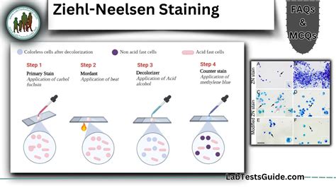 Process Of Zn Staining