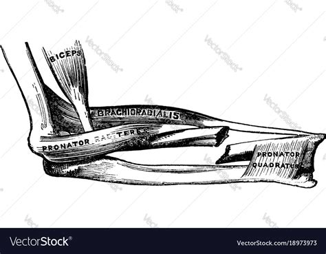 Image result for Fractured Radius