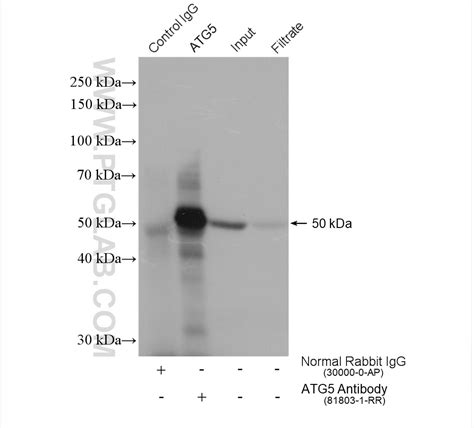 Autophagy Essentials Antibody Kit PK30004 | Proteintech