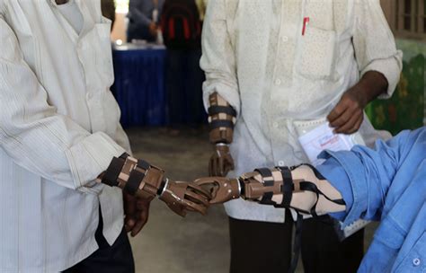 Revolutionary Solar-Powered Skin Technology For Prosthetic Limbs May ...