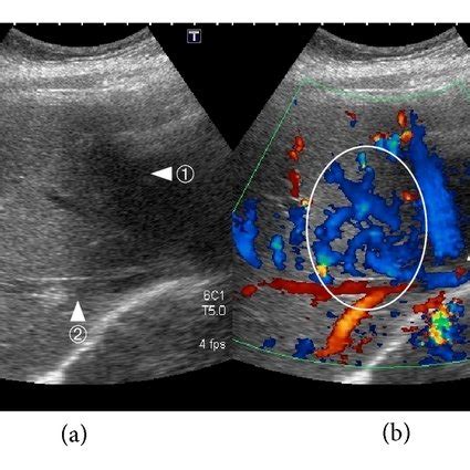 Image result for Ultrasound Lab