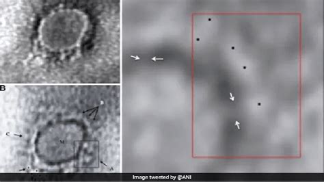 India releases first image of how Covid-19 virus looks like under ...