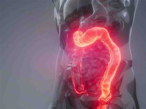 急性肠胃炎不能吃什么-肠胃炎饮食-复禾健康