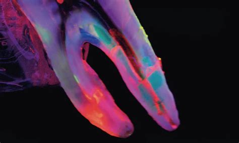 Restaurieren mit fließfähigen Kompositen | Quintessenz Verlags-GmbH