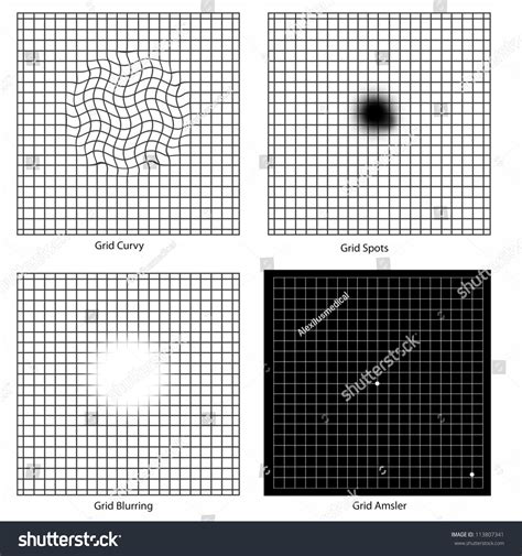 Amsler Grid Chart Types at Archer Delprat blog