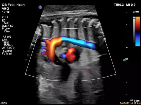 Philips - Affiniti 70 Ultrasound system