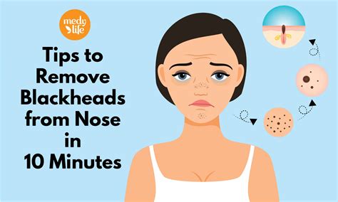Removing Blackheads On Nose
