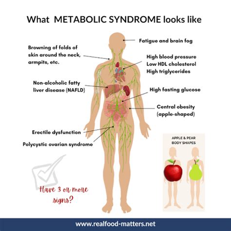 Image result for Cachexia Test