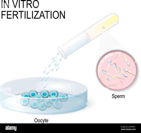 Sperm egg human not cg hi-res stock photography and images - Alamy