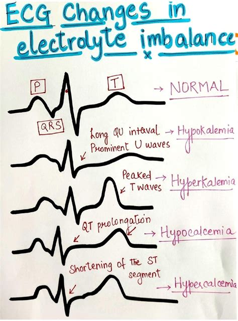 ECG Changes in Electrolyte Imbalance | Visual Guide for Medical Students