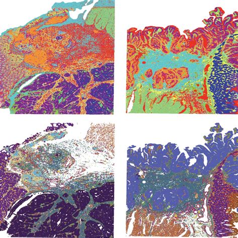 10X Spatial Transcriptomics 的图像结果