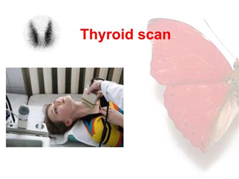 Thyroid Function Test Explained 的图像结果