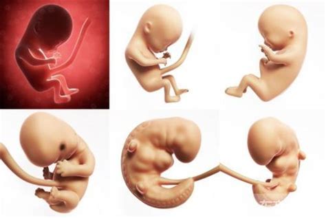 胎儿在子宫内缺氧会有什么后果 - 育儿知识