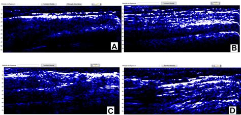 Intra- and inter-rater reliability of muscle and fat thickness measurements obtained using ...