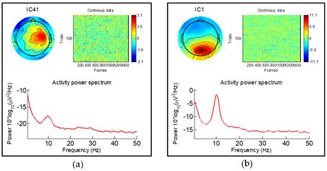 Long-Term EEG Component Analysis Method Based on Lasso Regression