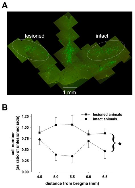 In Search of a Feedback Signal for Closed-Loop Deep Brain Stimulation ...