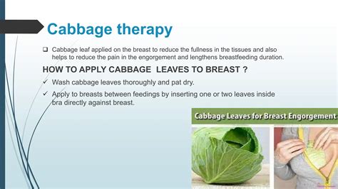 BREAST ENGORGEMENT and Its causes in female | PPTX