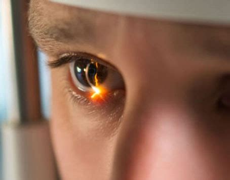 Stem Cell Therapy for Retinitis Pigmentosa Disease in India | Stem Cell ...