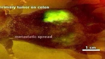 How Is Cancer Caused Animation View 的图像结果